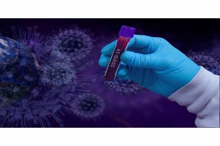 San-Fransisko limanında dayanan gəminin heyət &uuml;zvləri arasında koronavirusa yoluxma faktı qeydə alınıb